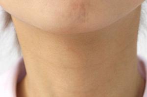 京都の幹細胞治療が評判になっています